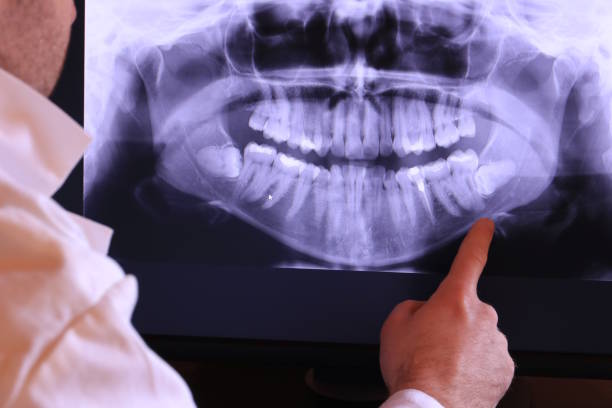 Best Emergency Dentist for Knocked-Out Tooth in Patrick Springs, VA