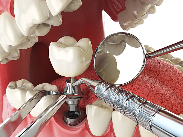 Best 24-Hour Emergency Dentist in Patrick Springs, VA