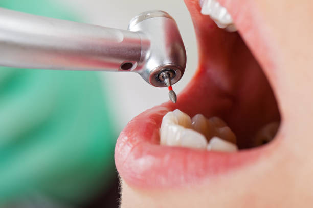 Best Weekend Emergency Dentist in Patrick Springs, VA